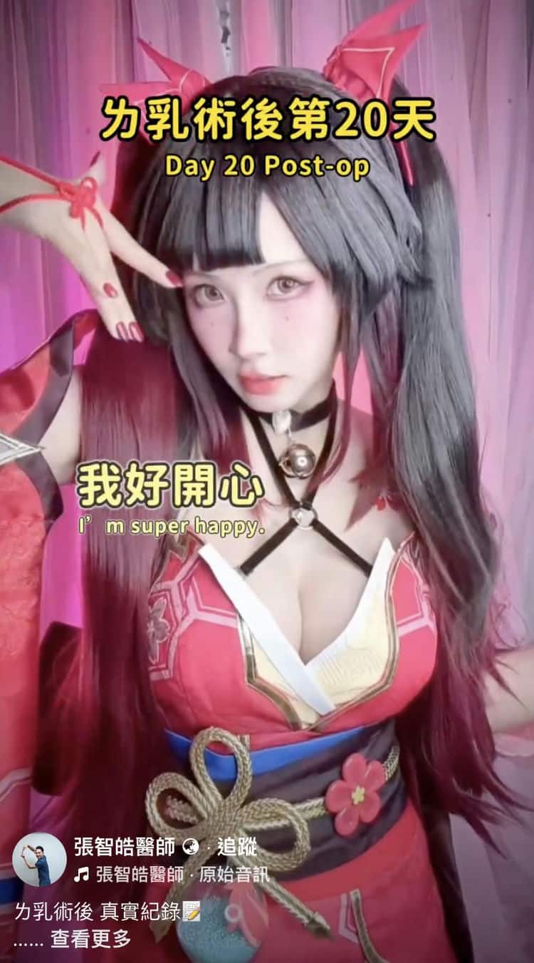 婚前隆乳真心話：張智皓醫師點樣幫我喺BigDay閃耀全場，連
